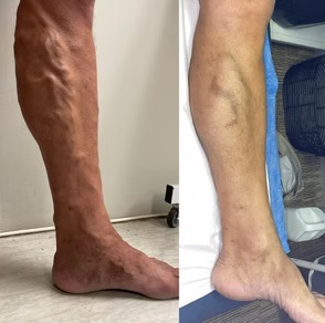 Before & After 1