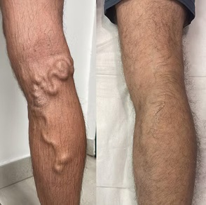 Before & After 2