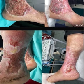 Before & After 4