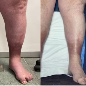 Before & After 5