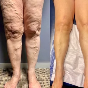 Before & After 7