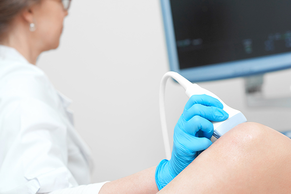 Ultrasound-Guided Foam Sclerotherapy